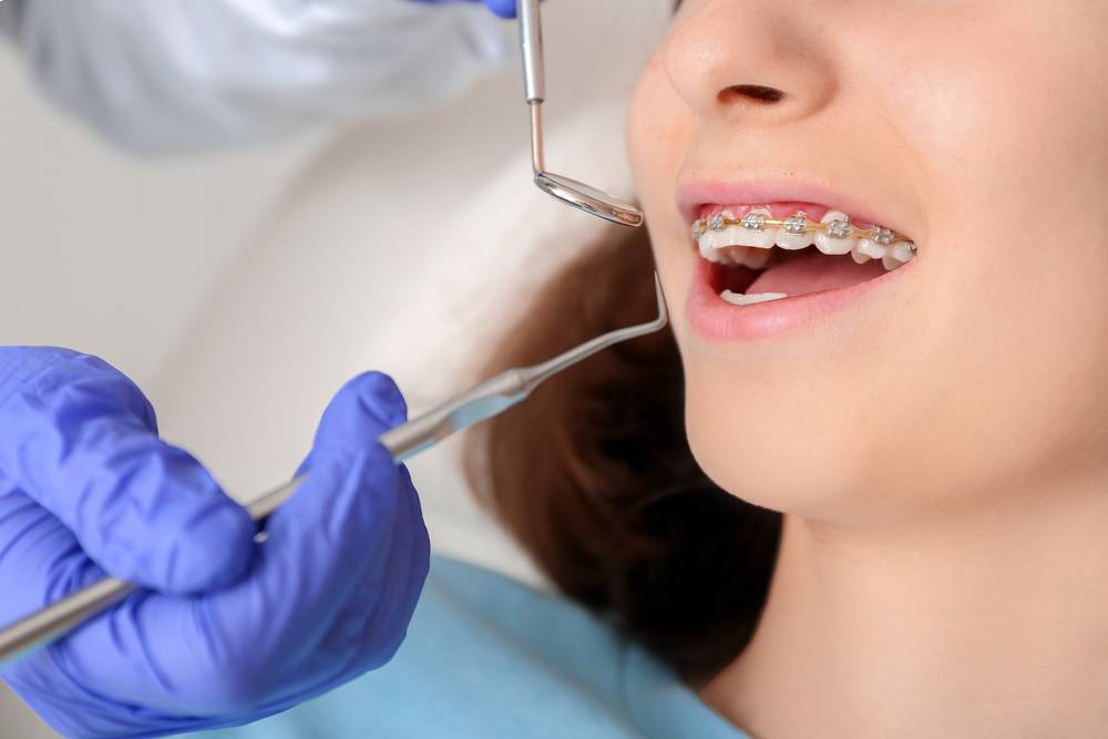 Selecting The Right Orthodontist For Your Oral Health Needs